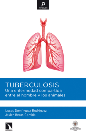 TUBERCULOSIS